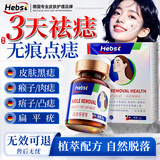HEBST去痣点痣膏专用药脸部不留疤祛痣膏点疣药水正品无痛无痕