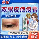 葵花开眼角疤痕贴割双眼皮修复祛疤膏手术后缝针凝胶增生凸起去除疙瘩 1盒装【硅酮凝胶】