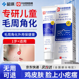 韶琪儿童脸上小疙瘩用的鸡皮肤去除神器毛周角化专用可搭药膏脸部50g