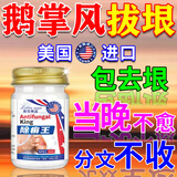 皇元妙醫鹅掌风专用膏药手癣真菌感染药正品膏脱皮开裂粗糙变厚止痒浸泡剂 1盒装【鹅掌风克星】 菌王手足癣真菌感染皮炎湿疹脚气