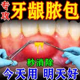 广雅千方百剂牙龈脓包肿痛鼓包化脓儿童智齿牙根发炎上火肿包流脓消炎专用喷剂 三盒特效装【消除脓包】买二送一