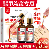 妙丹堂甲沟炎专用根去肉芽指甲长肉里消肿止痛严重息肉脚趾治特非药膏水 两盒装（中度甲沟炎的效：化脓、肉芽、息肉）