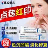 藤石制药激光点痣后脸部去红印黑印凹陷修复凝胶祛痣疤痕膏淡化红印色素DS 两盒装第二盒半价