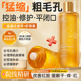 透真金盏花爽肤水控油祛痘收缩毛孔湿敷水保湿补水提亮去黄去闭口粉刺