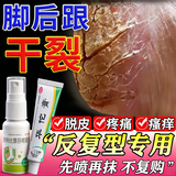 [科田]华佗膏 脚后跟真菌感染干裂脱皮专用药角化型脚气顽固性脚起硬皮脚干裂特新效药膏脚趾缝溃烂开裂药 华佗膏1支+盐酸特比萘芬喷雾剂1瓶 【一喷一抹】