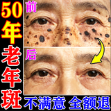 藤川岗田祛斑霜老年斑专用非药一夜消去斑去黑色素黄褐斑雀斑晒斑女士用的 拍1发3【各斑点一夜消】无效全退 特效的日本进口老年人斑男士白美淡斑去斑淡化医用正品