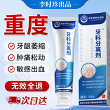 李时珍牙科分离剂牙龈萎缩牙齿松动固齿修复再生牙周炎专用正品牙膏状药 1盒试用装【护龈凝胶】