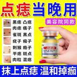 百易方点痣膏水疤痕修复脸去痣膏祛斑点斑专用官方正品(药监备案)点疣水 1盒装新款【点痣专用】 点痣膏美容院专用去黑痣脸部无痛无痕医用专用