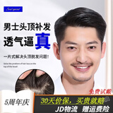 soul special假发男 真发假发片 补发块 男士补发真发头顶补发片隐形补发块 高级仿真头皮毛坯款 14*19 可修剪 自然黑
