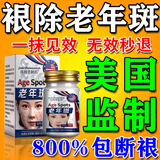 肤研祛斑霜去老年斑专用特效非药一夜消黄褐斑雀斑晒斑女男士医用的药 特效膏三盒【100%去除】买2送1 强力祛除手部脸部淡化黑色素纯中药正品非进口