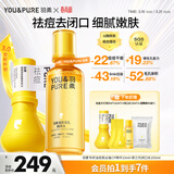 羽素祛痘大灯泡闭口水套组 祛痘闭口粉刺收缩毛孔补水护肤品套装