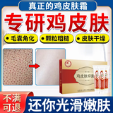 奇力康鸡皮肤疙瘩毛囊角化症专用非药去角质疙瘩大腿手臂去除神器特傚 买2送1（用完不自卑了） 鸡皮肤毛周角化专用