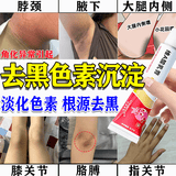 [良福制药]维A酸乳膏 角化异常引起去黑色素沉淀去除脖子腋下屁股黑棘皮私处大腿内侧腋下淡化黑色素药膏 0.1%*15g 1盒装 【软化角质 淡化色素】