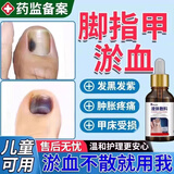 代文脚趾甲被砸指甲被夹压受损瘀血发黑甲床受伤甲下淤血发紫生长液TU 单盒装 指甲被压淤血了变黑受损药房同售