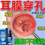 藤石制药耳道清洗液耳膜穿孔修复专用滴耳液鼓膜穿孔流脓化脓性中耳炎XT 三盒周期装【耳内闷塞 听力下降】