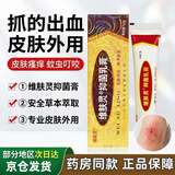 祥醫堂维肤灵抑菌乳膏皮肤成人外用软膏草本抑菌软膏真菌感染皮肤瘙痒