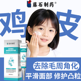 藤石制药儿童鸡皮肤毛周角化去除神器药脸部软化毛囊角化症脸上有小颗粒O6 买2送1 送棉签【疗程装】疗程下单 无用可退专用