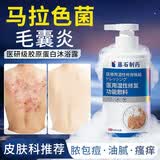 藤石制药马拉色菌毛囊炎专用沐浴露后背长痘痘痤疮男士可搭祛痘硫磺皂GU 沐浴露2盒【第二盒半价】温和不刺激毛囊 【正品保障】医用湿性修复功能敷料
