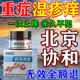 北京协和医学院湿疹药膏十大牌子皮肤瘙痒皮炎湿疹真菌感染止痒膏抑菌去顽固湿毒 特效升级【1盒】北京协和出品 止痒抑菌皮肤瘙痒去顽固湿毒进口