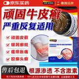 DR.SOKK顽固牛皮癣膏真菌王银屑病止痒膏股藓抑菌膏手足脚体藓专用非药