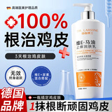 DR.LARSSNE 郎森博士尿素霜维e乳膏止痒去鸡皮肤舒缓干燥保湿止痒去屑换季嫩白全身乳