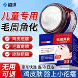 韶琪儿童脸上小疙瘩用的鸡皮肤去除神器毛周角化专用可搭药膏脸部30g