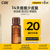 C咖酸酶水控油爽肤水去闭口精华水油皮美白湿敷化妆水喷雾祛痘护肤品 【随行便携】祛痘水35ml