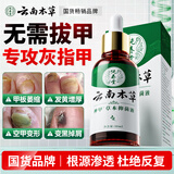 纯春堂云南本草灰指甲专用特殊效中草药抑菌液增厚发黄中空灰甲净护理盒