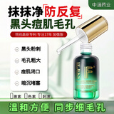 中涵国际黑头一抹净收缩毛孔去黑头祛闭口粉刺溶解精华能量液男女 加强版15ml（无赠品）型号备注