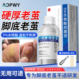 ADPWY水杨酸抑菌液脚底老茧去除可搭老茧软化膏茧子去除硬皮100ml