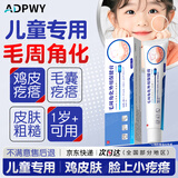 ADPWY儿童脸上小颗粒小疙瘩鸡皮肤去除神器毛周角化专用可搭药膏青少年