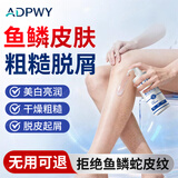 ADPWY鱼鳞皮肤身体乳腿干燥起皮鱼鳞皮肤霜小腿鱼鳞腿部专用搭药膏润肤
