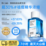 蓓安亲研小蓝瓶祛痘精华液3.0 快速水杨酸面部祛痘修护 去闭口粉刺10ml