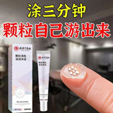 颗粒清肌滋润眼霜去眼周脂肪粒油脂粒汗管瘤眼部护理专用紧致眼霜 3盒【基础装】 初见效果