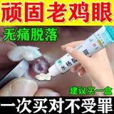 [信龙]水杨酸软膏 5%*20g 1盒装 鸡眼膏去i根肉刺药膏无痛脱落连根拔非贴成人去刺猴跖疣老茧脚鸡眼去除特新效期药去疣 皮肤增厚疼痛15年小鸡眼