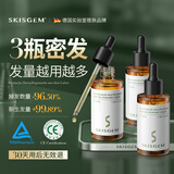 SKISGEM德国进口防脱固发焕活精华液高端生长营养液增长固发男女头皮护理 防脱精华液150ml【发缝稀疏：育发生发】