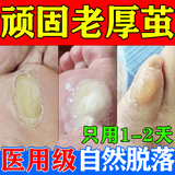 [信龙]水杨酸软膏 5%*20g 1盒装 去脚底老茧去硬皮老茧软化膏茧子去除去老茧去脚底老茧硬皮鸡眼膏去肉刺药膏根无痛脱落 医用级药膏