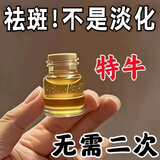 祛斑专用水一擦就掉点斑不留疤美容院点斑水祛雀斑净去 1盒 【2瓶装】金水+修复液