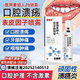康瑞保重组人表皮生i长因子口腔溃疡喷雾医用修复口腔黏膜伤口愈合再生 医用重组【a2b喷剂型25ml】 【京仓发货】口腔专用