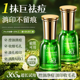 OHBT茶树祛痘精华淡化痘印去痘痘收毛孔男女士护肤品青春期学生专用