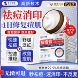 本安制药祛痘药膏青春痘祛痘淡化痘印痘坑痤疮粉刺专用青少年1盒