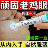 [信龙]水杨酸软膏 5%*20g 1盒装 去脚底老茧去硬皮老茧软化膏茧子去除去老茧去脚底老茧硬皮鸡眼膏去肉刺药膏根无痛脱落 鸡眼膏去看看根肉刺药膏