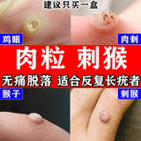 [臣功]维A酸乳膏 15克/支 1盒装 刺猴去好根瘊疣膏猴子去除药膏猴子扁平疣去除药膏刺猴专用的药特寻常疣鱼鳞痣小肉粒效 肉粒刺猴疙瘩在萌芽期使用