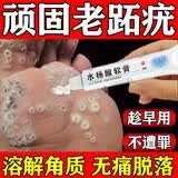 [信龙]水杨酸软膏 5%*20g 1盒装 鸡眼膏去i根肉刺药膏无痛脱落连根拔非贴成人去刺猴跖疣老茧脚鸡眼去除特新效期药去疣 跖疣专用药脚底趾疣去疣根