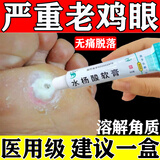 [信龙]水杨酸软膏 5%*20g 3盒装 鸡眼膏去i根肉刺药膏无痛脱落连根拔非贴成人去刺猴跖疣老茧脚鸡眼去除特新效期药去疣 严重反复鸡眼跖疣早用早治