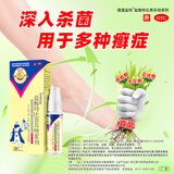 南洋盐酸特比萘芬喷雾剂1%*15ml/盒 治疗手癣 足癣 花斑癣 股癣等癣症