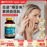 herbs of gold和丽康祛痘小蓝瓶 内调淡化痘印缓解痤疮 含金盏花+vb6 澳洲进口