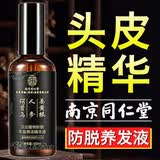 南京同仁堂防脱养发液激活毛囊增发密发长发剂防脱发头皮精华头发生长营养液 【三瓶】适合发际线高后移人群