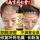 同仁堂生姜防脱洗发水防脱发育发固发养发密发增发控油蓬松老姜王 500ml 三瓶装 一疗程 【激活毛囊-浓密头发】万人回购