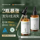 SKISGEM德国进口防脱固发焕活精华液高端生长营养液增长固发男女头皮护理 防脱精华液100ml【发际线修护：密发填充】